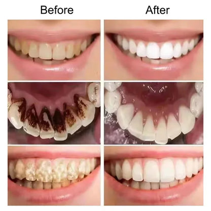 Purple Teeth Whitening Toothpaste