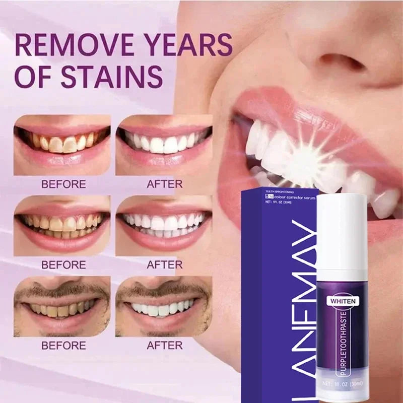 Purple Teeth Whitening Toothpaste